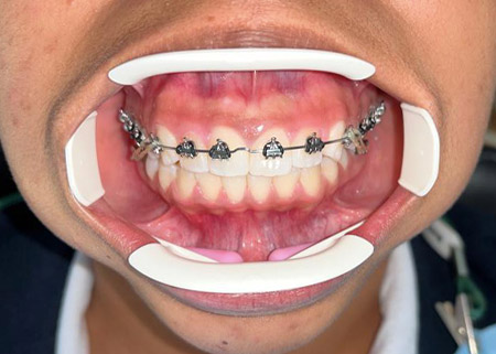 ortho