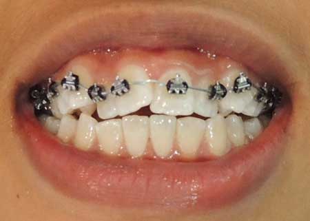 ortho_01