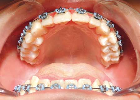 ortho_01_after