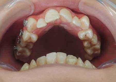 ortho_01_before